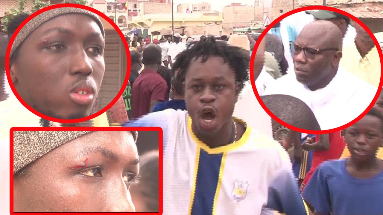 (vidéo)Législatives 2022: Bat@ille rangée à Guediawaye des blessés enregistrés dans le camp du pouvoir